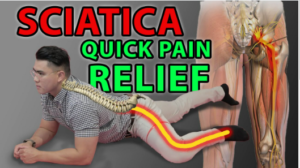 Sciatica Supportive Therapy